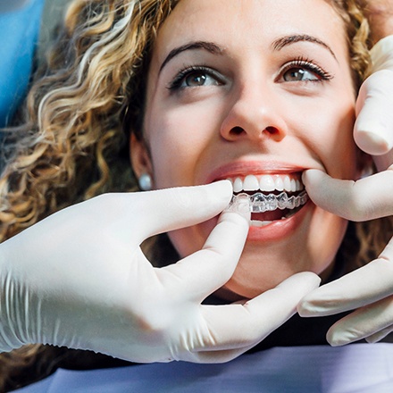 Gloved hands inserting clear aligner over woman’s upper arch