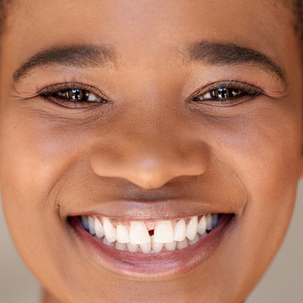 Woman with gap between upper front teeth smiling
