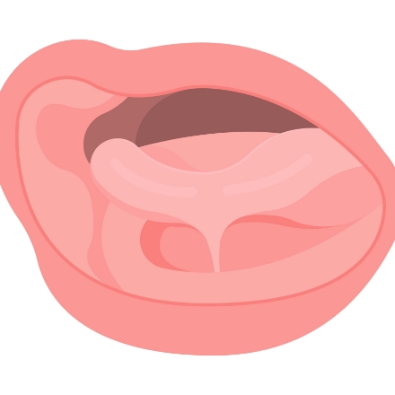 Animated smile with lip and tongue tie